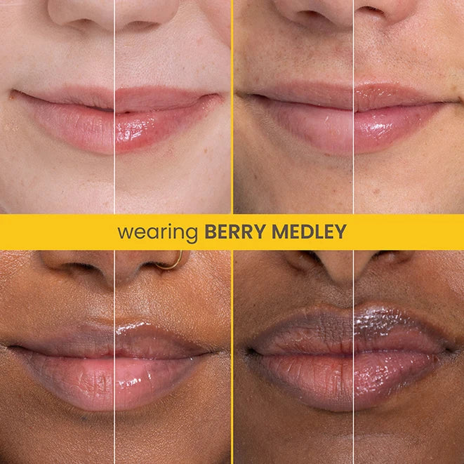 Rescue Lip Relief