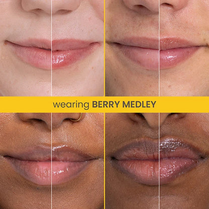 Rescue Lip Relief